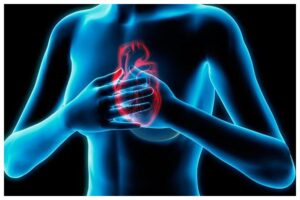 Heart Attacks In Women (1)