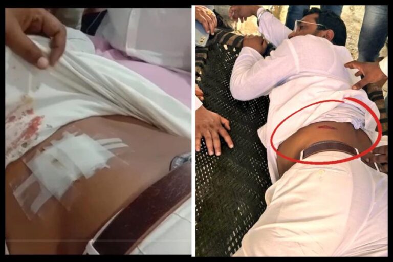 Chandrashekhar Azad Attacked : भीम आर्मी चीफ चंद्रशेखर आजाद पर जानलेवा हमला