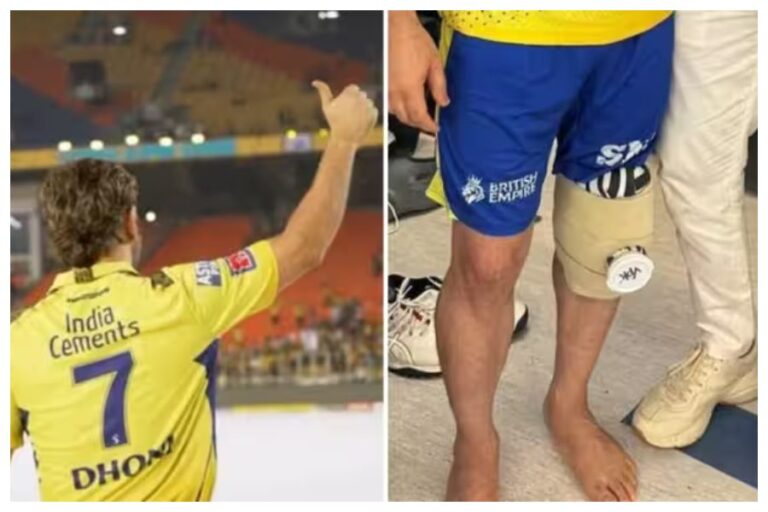Dhoni surgery successful in Mumbai's kokilaben hospital