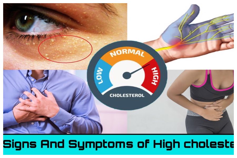 High Cholesterol Symptoms