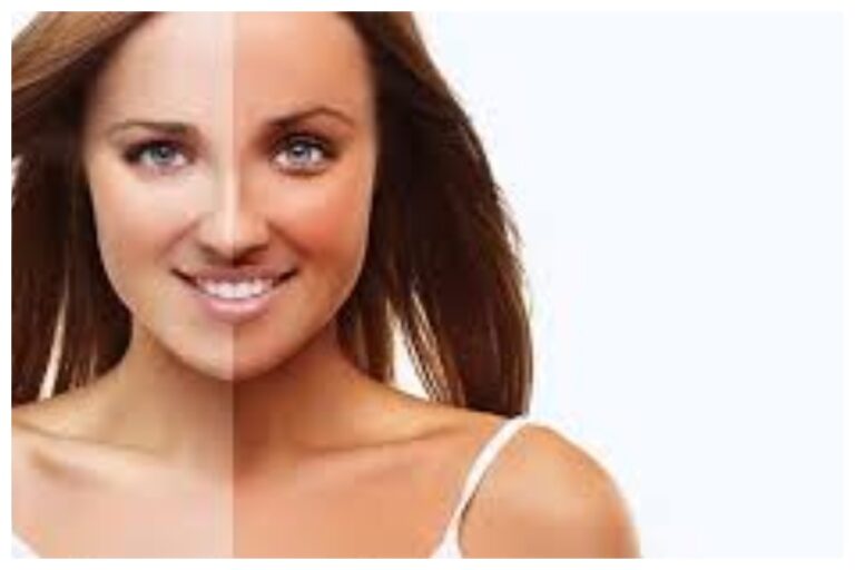 Tanning Home Remedies: किचन के इन सामानों से पाएं जिद्दी डार्क स्पॉट्स से तुरंत छुटकारा