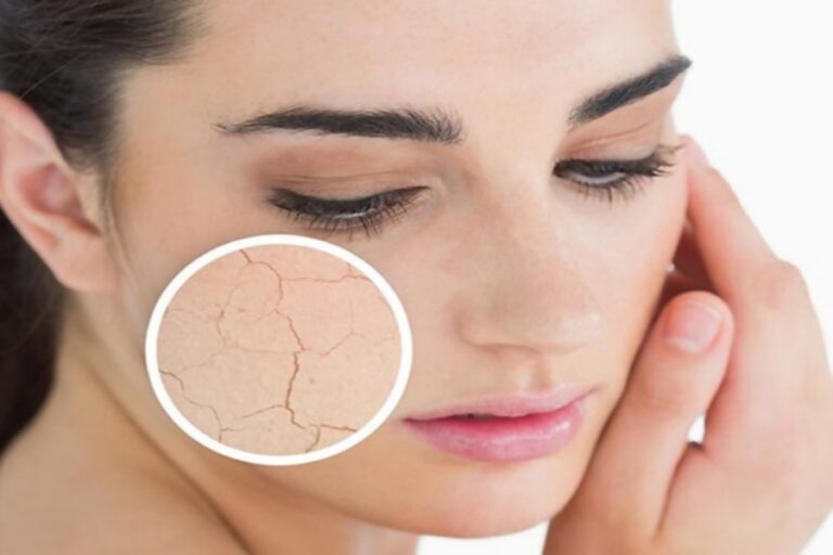 ड्राई स्किन वाले अपने चेहरे पर यूज करें यहां सभी नुस्खें