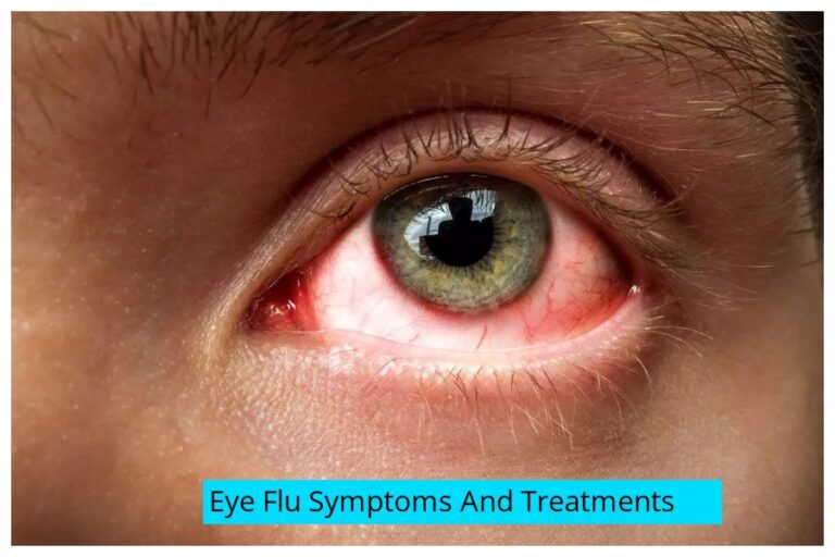 Eye Flu Symptoms And Treatments: बारिश ने बढ़ाया ‘Eye Flu’ का खतरा, ये हैं लक्षण और बचाव के उपाय