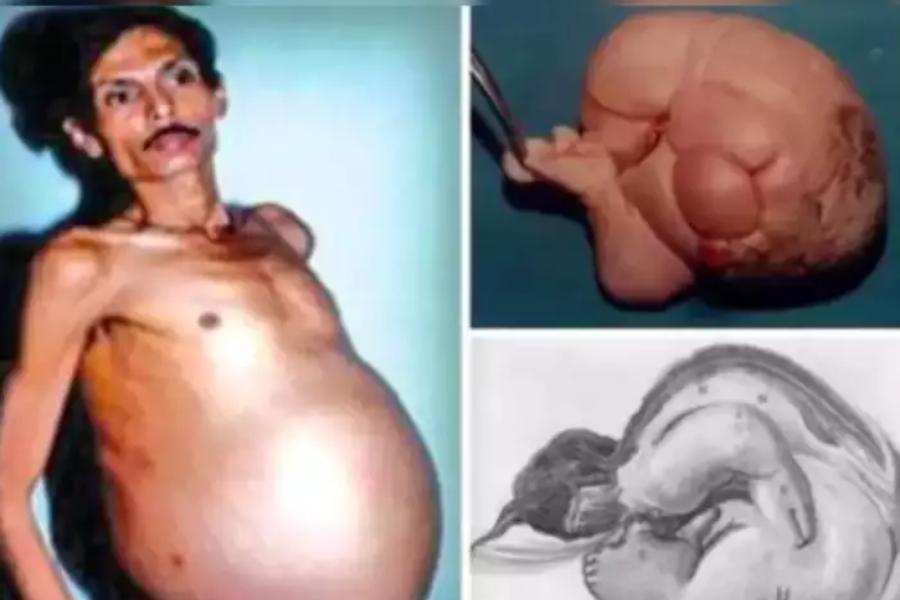 Pregnant Man Pregnant Man