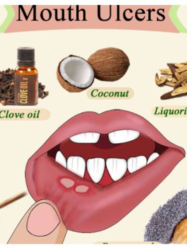 mouth 8