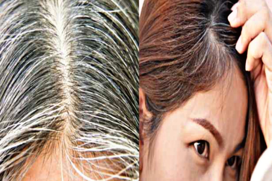 white hair solution