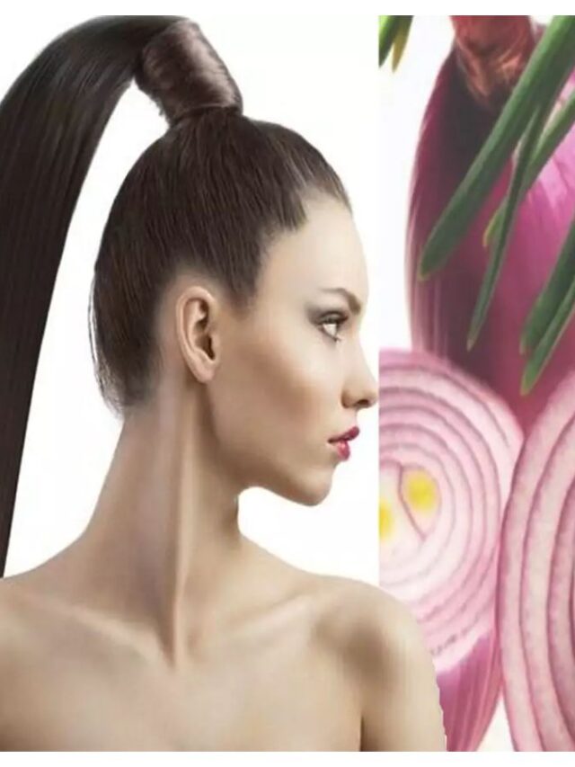 onion 10