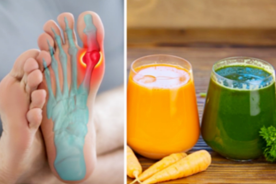 Uric Acid Problem