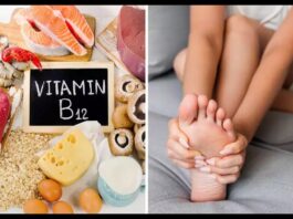 Vitamins B-12 Deficiency