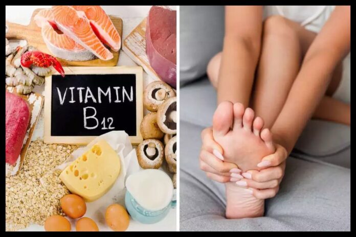 Vitamins B-12 Deficiency Vitamins B-12 Deficiency
