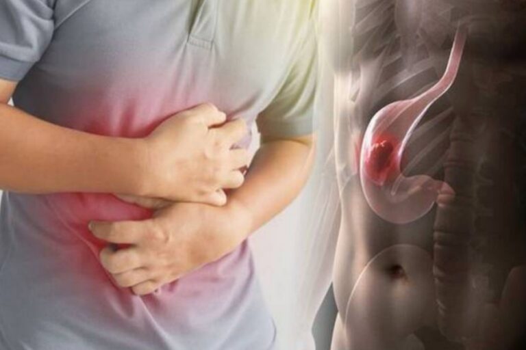 चुटकियों में झटपट करें गैस वाली प्रॉब्लम को दूर, करें यह सभी टिप्स फॉलो