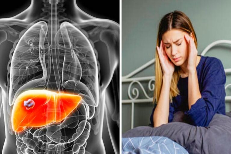 ये सभी चीजें आपके लीवर की बजा देंगी बैंड, हो जाए सावधान! सेवन किया तो होगा बड़ा खतरा…