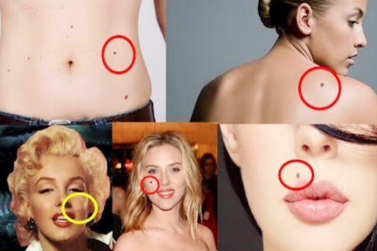 अगर आपके शरीर में इन अंगों पर है काला तिल, तो आपका होगा बड़ा नुकसान….