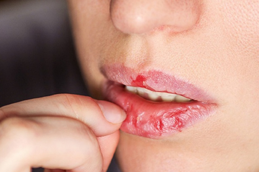 Lips Care Tips
