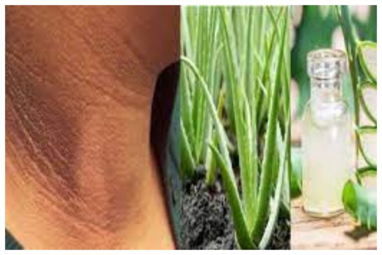 Neck Darkness Home Remedies: गर्दन का कालापन अब झट से दूर, एलोवेरा में मिलाकर लगालें ये चीजें