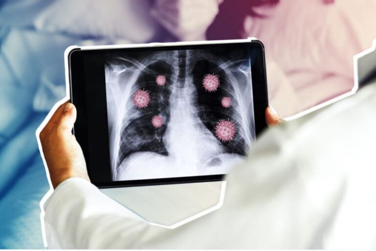 Pneumonia Symptoms: यह सभी लक्षण निमोनिया की तरफ करते है इशारा, जानें और हो जाए सतर्क