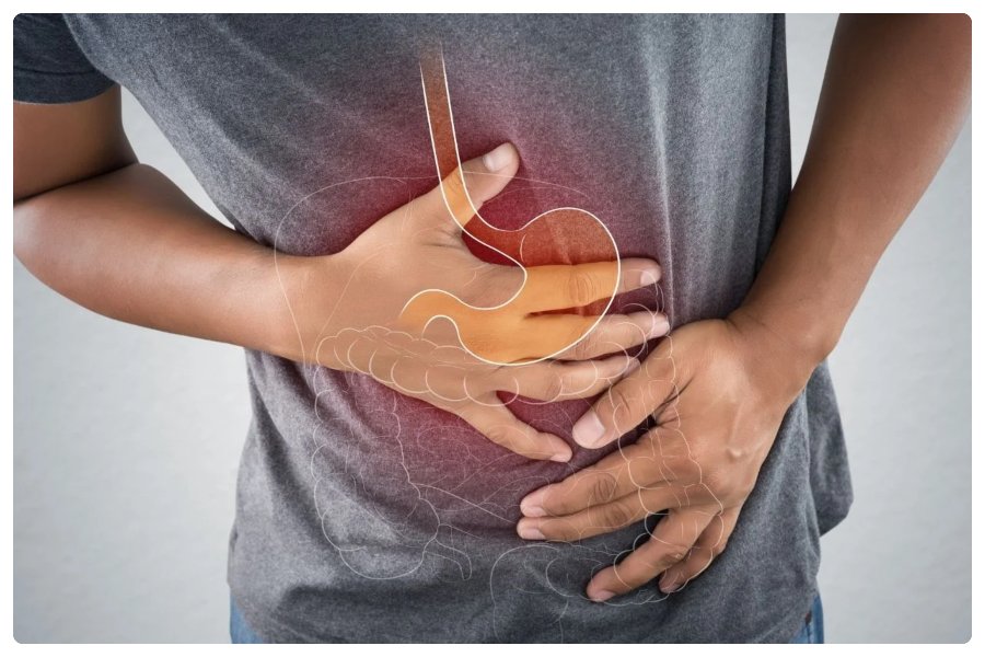 Stomach Cancer Stomach Cancer