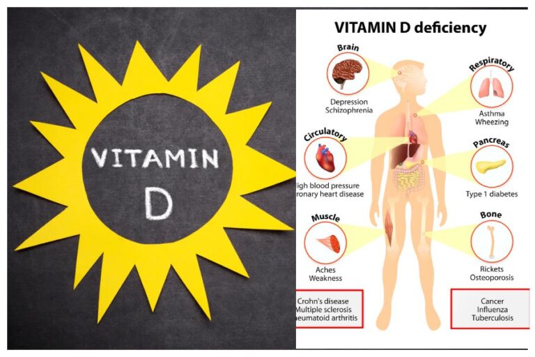 Vitamin D Benefits: हड्डियों की मजबूती और विटामिन D के लिए धूप में बैठने का सबसे सही समय जानें यहां