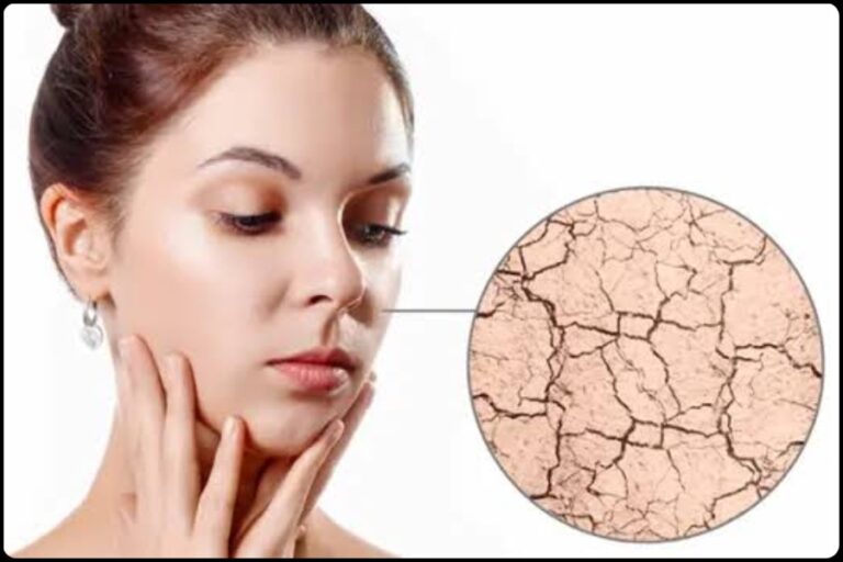 Beauty Tips : त्वचा के रूखापन को दूर करने के लिए करें यह घरेलू उपाय, निखर जाएगा चेहरा
