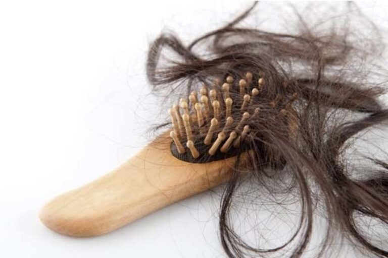 How To Stop Hair Fall : इस विटामिन कमी से झड़ते हैं बाल, खाने में कम करें नमक की मात्रा