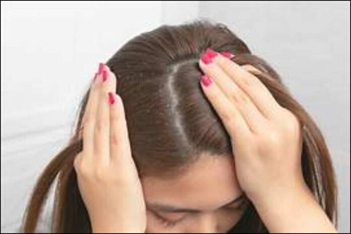 Get Rid Of Dandruff