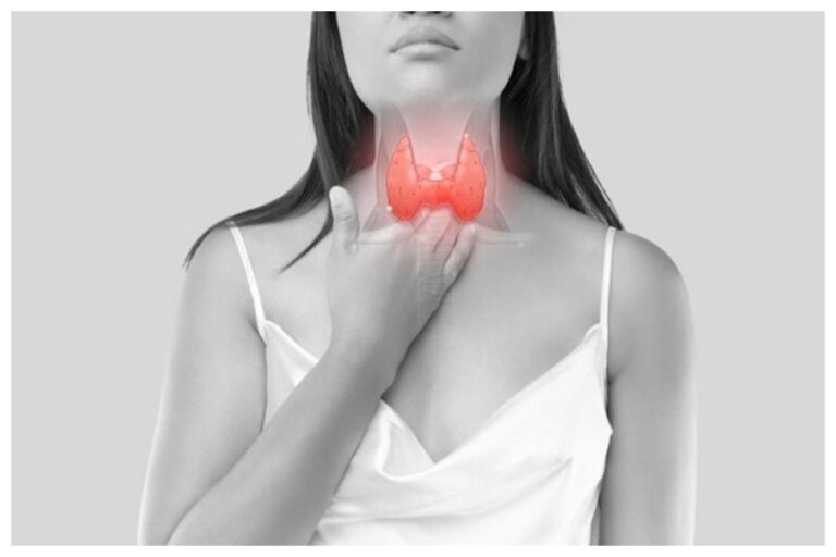 Iodine Deficiency: आयोडीन की कमी होने पर शरीर देता है ये संकेत, इलाज के लिए करें ये काम