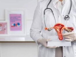 Ovarian Cyst