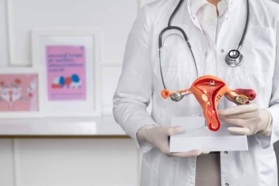 Ovarian Cyst Ovarian Cyst