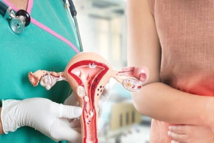 Cervical Cancer