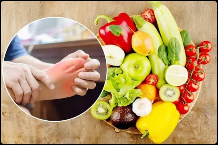 Reduce Uric Acid