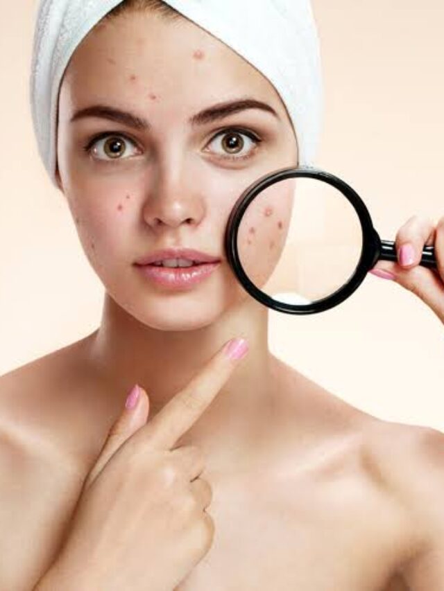 Skin Cancer