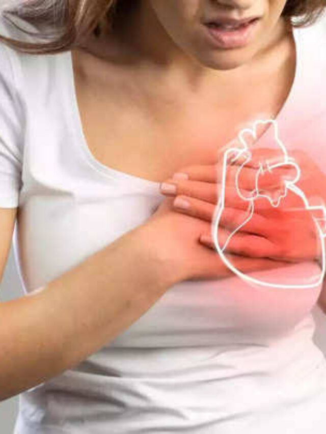 Cardiac Arrest
