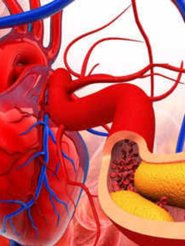 Seeds for Bad Cholesterol: खराब कोलेस्ट्रॉल को जड़ से उखाड़ फेंकते हैं किचन में पाए जाने वाले ये बीज