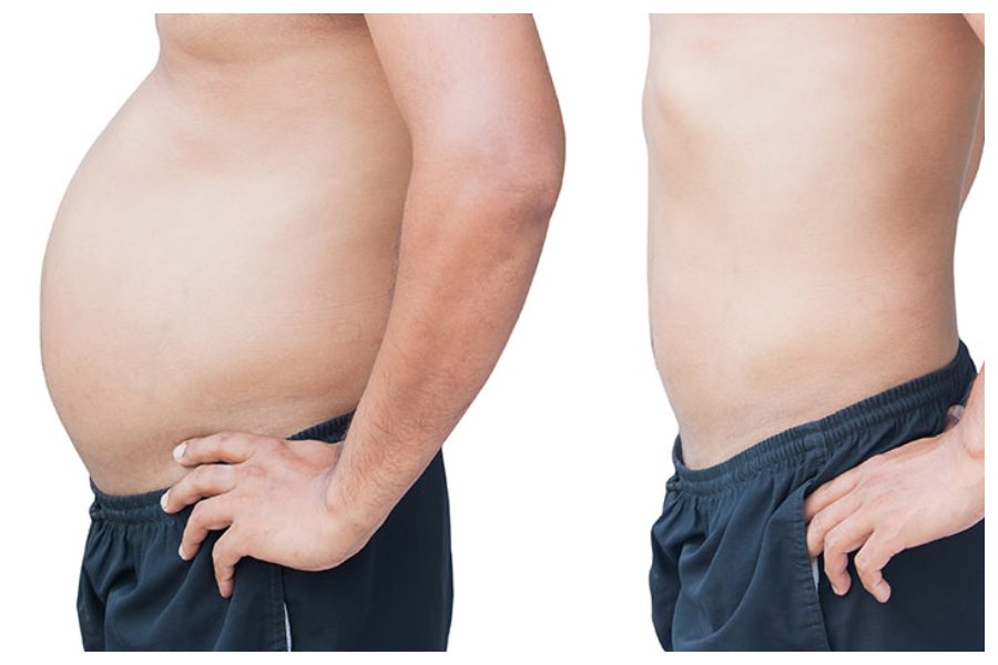 Belly Fat