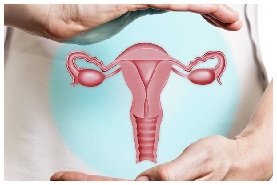 Cervical Cancer