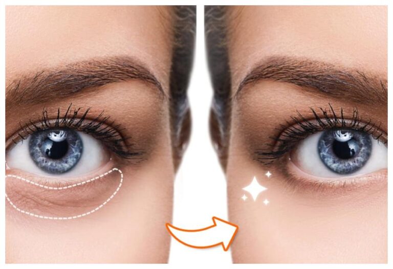 Tips Of Removing Dark Circle: इन 7 घरेलु नुस्खों से डार्क सर्कल कुछ मिनटो में हो जाएंगे छूमंतर.. अभी से अपना लें ये