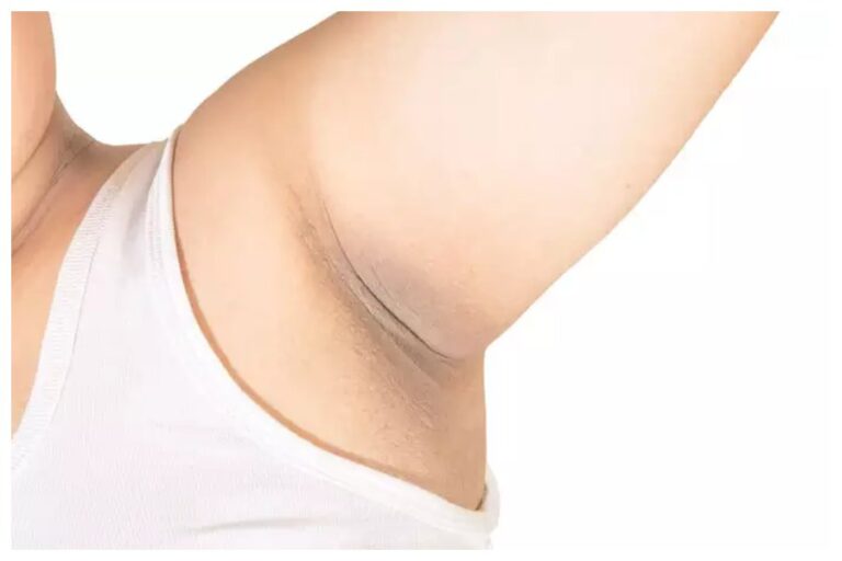 Underarms Cleaning Tips: झट से दूर हो जाएगी डार्क अंडरआर्म्स की समस्या, ये घरेलू उपाय हैं रामबाण, आप भी जानें