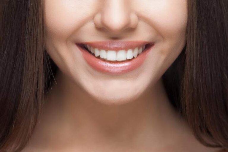 Yellow Teeth Problem