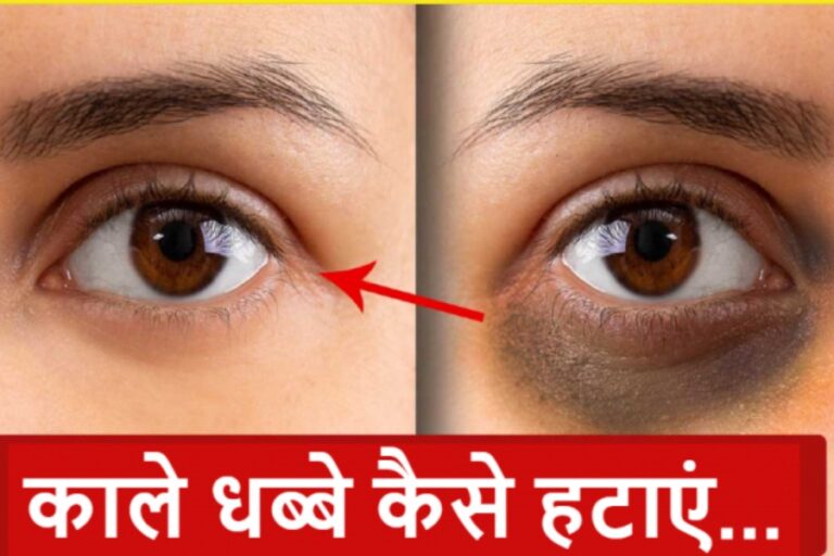 Beauty Tips: इन घरेलु उपाय से दूर हो जाएंगे आँखो के निचे के काले घेरे, खूबसूरत बन जाएगी स्किन