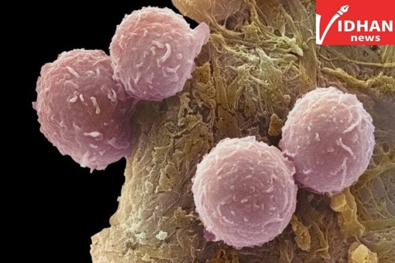 Cancer Treatment: अब बिना कीमोथेरेपी ही कैंसर हो जाएगा ठीक, चंडीगढ़ PGI को मिली कामयाबी