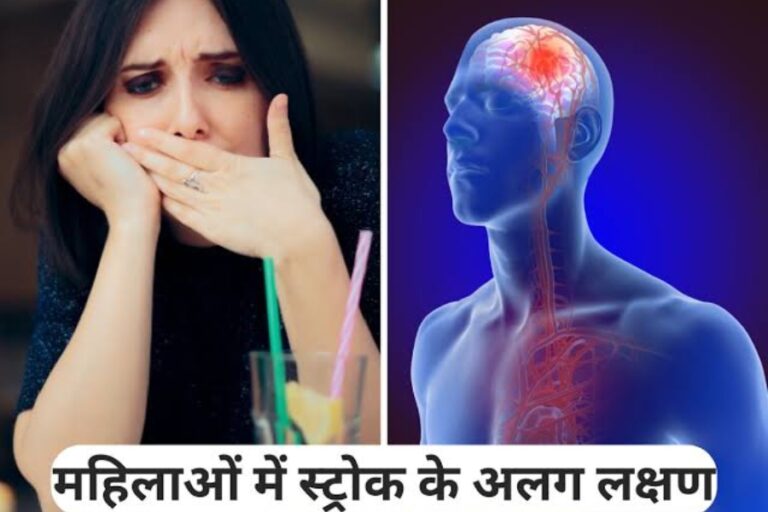 Brain Stroke आने से पहले महिलाओं के शरीर में देखने लगते हैं ये 5 लक्षण, तुरंत हो जाएं सावधान
