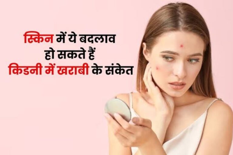 खुजली के साथ अगर स्किन में हो रहा है यह बदलाव, तो तुरंत हो जाएं सावधान! किडनी डैमेज का हो सकता हैं संकेत