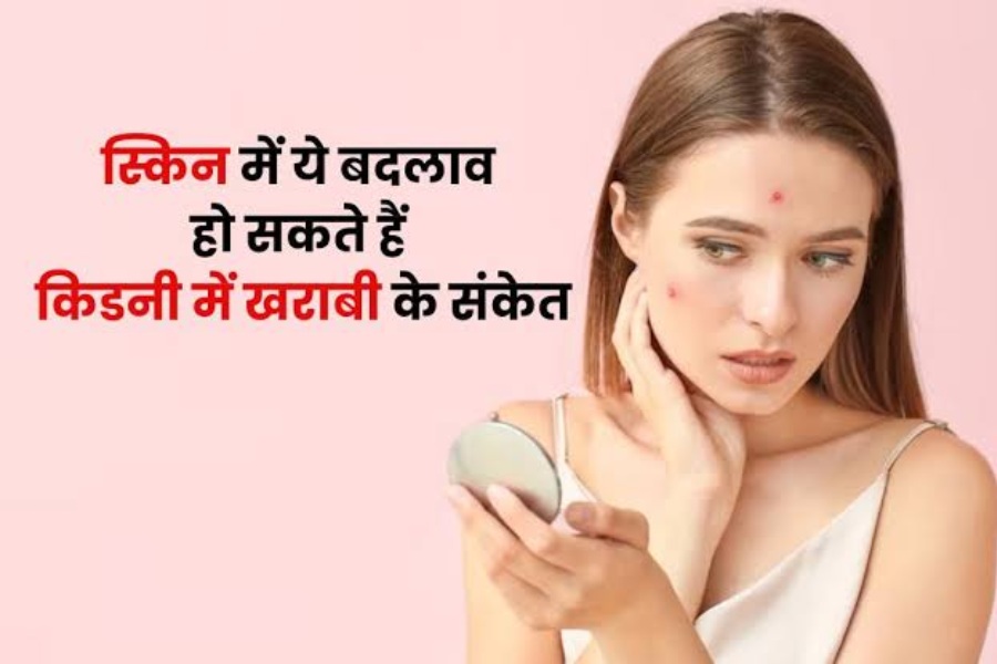 Kidney damage symptoms