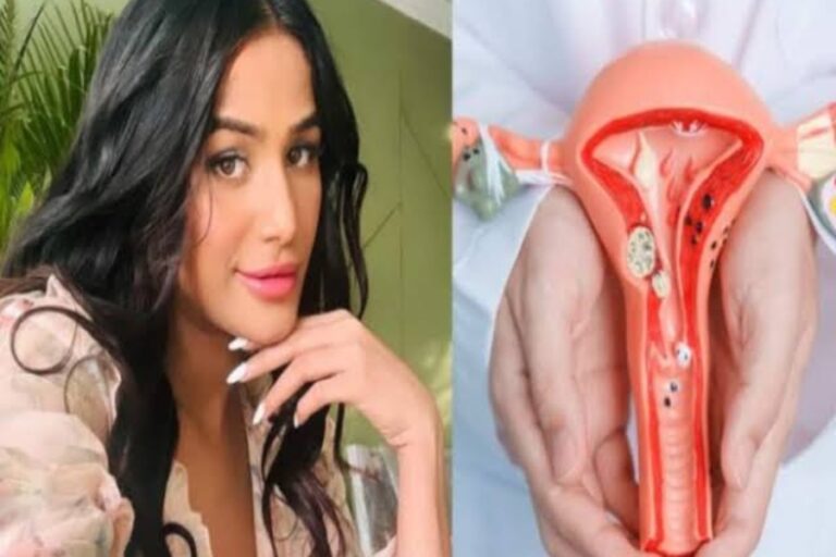 Cervical Cancer से हुई Poonam Pandey की मौत, जानिए क्या है इस बीमारी के शुरुआती लक्षण 