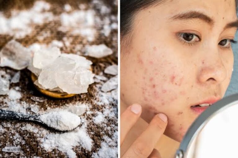 Alum On Face: अगर चेहरे पर लगाते हैं फिटकरी तो हो जाएं सावधान, चेहरे को हो सकते है ये गंभीर नुकसान