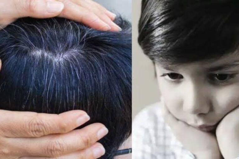 Hair Care: बच्चों के असमय बाल सफेद होने से रोकेंगे ये 5 नेचुरल फूड, हेयर फॉल से भी करते हैं बचाव