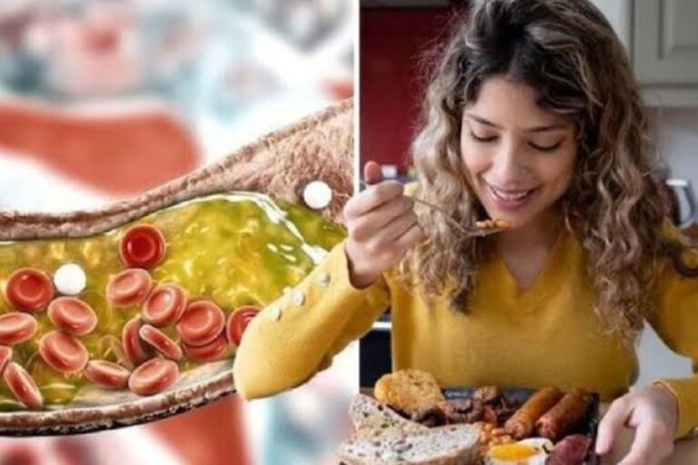 कोलेस्ट्रॉल बढ़ने पर इन चीजों का करें सेवन, सेहत के लिए होता है फायदेमंद