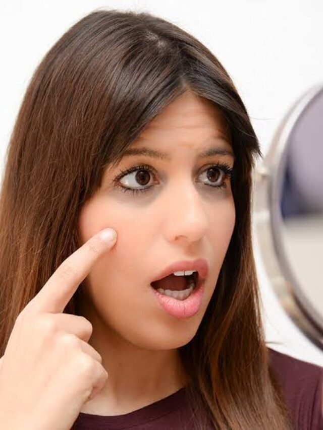 Dark Circle Remedies: आंखों के नीचे के डार्क सर्कल्स को हमेशा के लिए दूर कर देंगे ये घरेलू उपाय