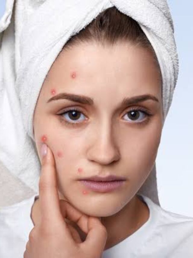 Skin Care