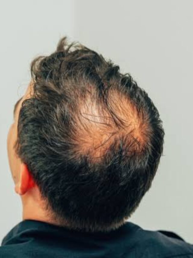 Hair Care Tips